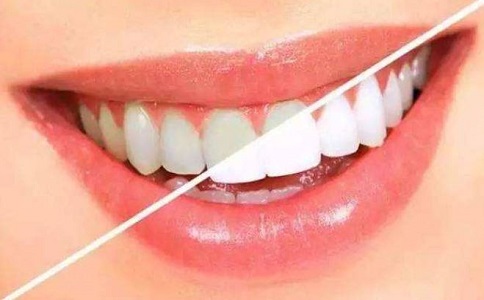 美牙护牙的十个方法